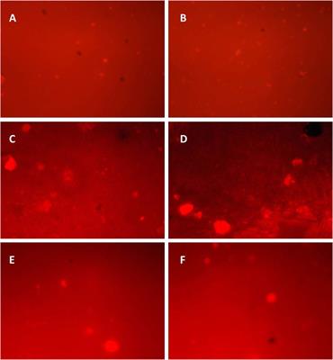 Sewage Sludge-Induced Effect on Growth, Enzyme Inhibition, and Genotoxicity can be Ameliorated Using Wheat Straw and Biochar in Pheretima posthuma Earthworms